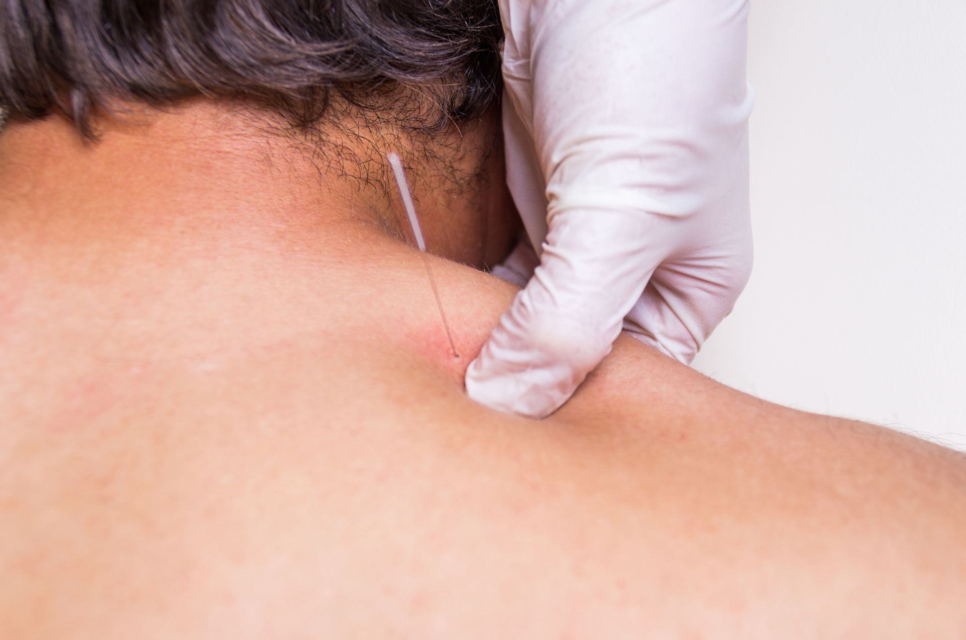 Fisioterapia invasiva